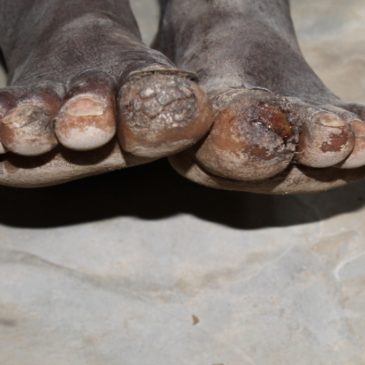 APPEL AU DON : Besoin de chaussures pour enfant pour le Kenya